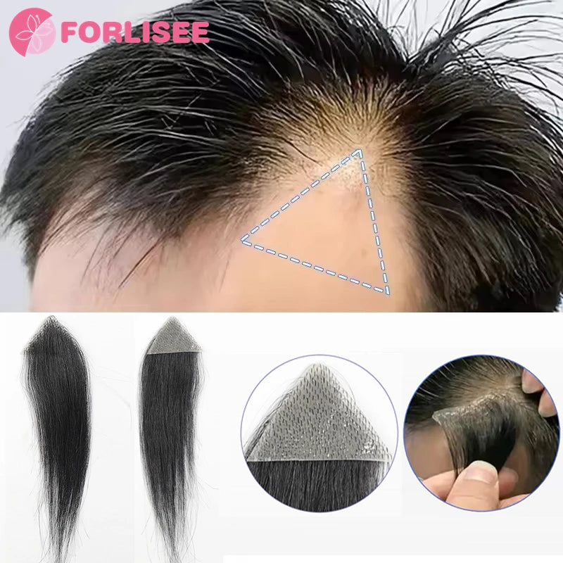 Forehead Patch Hairpiece Sideburns Toupee Invisible Seamless Ultra Thin Skin PU Men's Hairline Sideburn Patch Scar Hair Patch